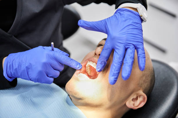 Best Emergency Dental Care for Broken or Chipped Teeth in Arapahoe, NE
